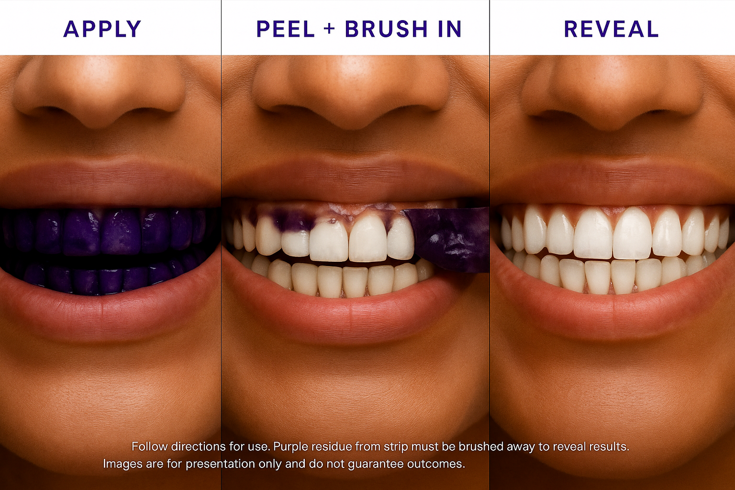7 Teeth Whitening Strips - GlorySmile®